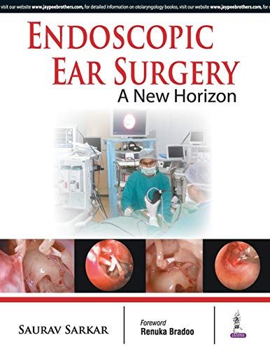Endoscopic Ear Surgery A New Horizon