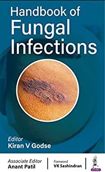 Handbook Of Fungal Infections