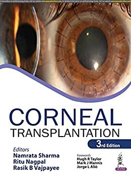 Corneal Transplantation, 3rd Edition