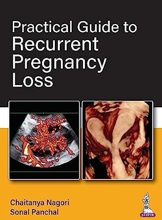 Practical Guide To Recurrent Pregnancy Loss