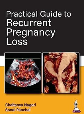 Practical Guide To Recurrent Pregnancy Loss