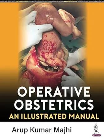 Operative Obstetrics: An Illustrated Manual