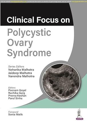 Clinical Focus on Polycystic Ovary Syndrome