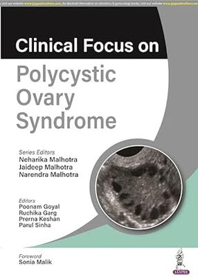 Clinical Focus on Polycystic Ovary Syndrome