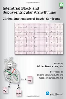 Interatrial block and supraventricular arrhythmias