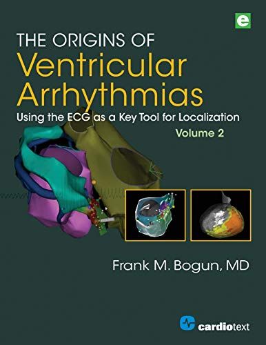 The Origins Of Ventricular Arrhythmias: Using The ECG As A Key Tool For Localization, Volume 2