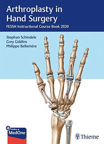 Arthroplasty In Hand Surgery: Fessh Instructional Course Book 2020