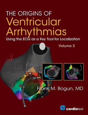 The Origins Of Ventricular Arrhythmias: Using The ECG As A Key Tool For Localization