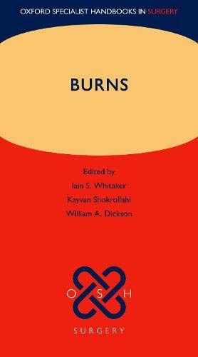 Oxford Specialist Handbook of Burns