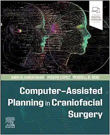 Computer-Assisted Planning In Craniofacial Surgery