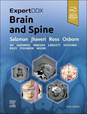 ExpertDDx: Brain and Spine, third edition