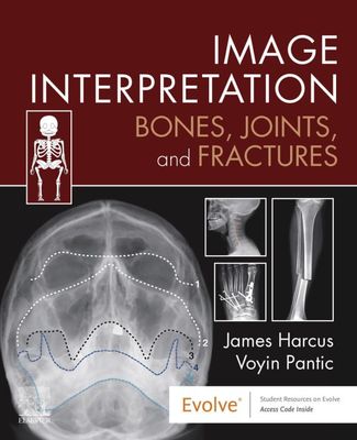 Image Interpretation: Bones, Joints, And Fractures