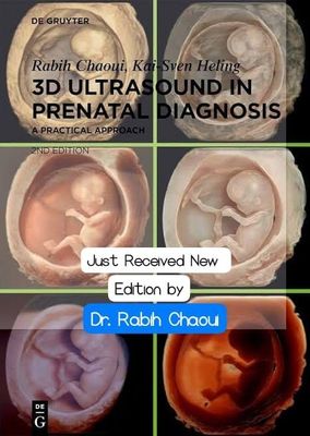 3D ultrasound in prenatal diagnosis
A Practical Approach 2nd Edition 2024