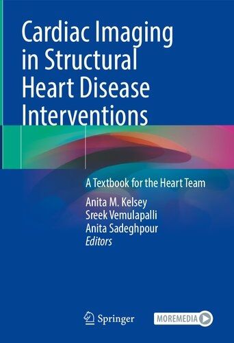 Cardiac imaging in structural heart disease interventions 2024