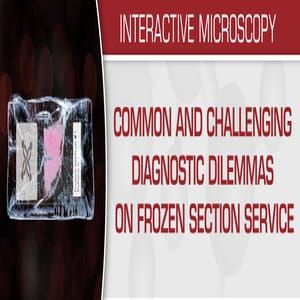 Common And Challenging Diagnostic Dilemmas On Frozen Section Service 2020 (Videos)