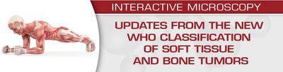 USCAP Updates From The New WHO Classification Of Soft Tissue And Bone Tumors 2020 (Videos)