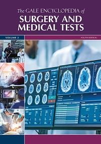The Gale Encyclopedia Of Surgery And Medical Tests, 4th Edition