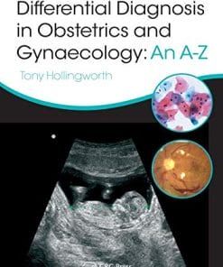 Differential Diagnosis in Obstetrics &amp; Gynaecology: An A-Z, Second Edition