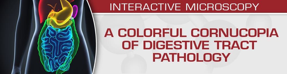 A Colorful Cornucopia Of Digestive Tract Pathology 2022