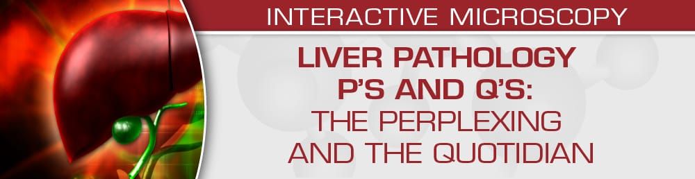 USCAP Liver Pathology P’s And Q’s: The Perplexing And The Quotidian 2022 (Videos)