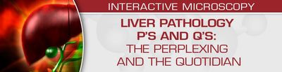USCAP Liver Pathology P’s And Q’s: The Perplexing And The Quotidian 2022 (Videos)