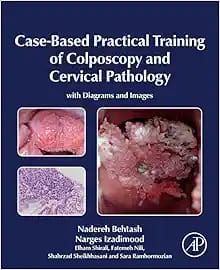 Case-Based Practical Training Of Colposcopy And Cervical Pathology: With Diagrams And Images