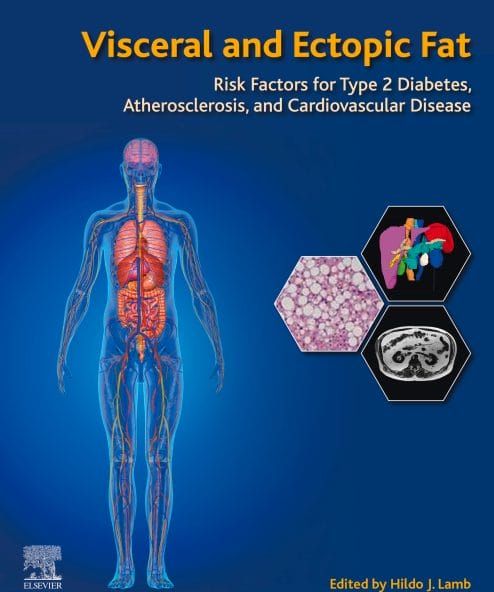 Visceral and Ectopic Fat: Risk Factors for Type 2 Diabetes, Atherosclerosis, and Cardiovascular Disease