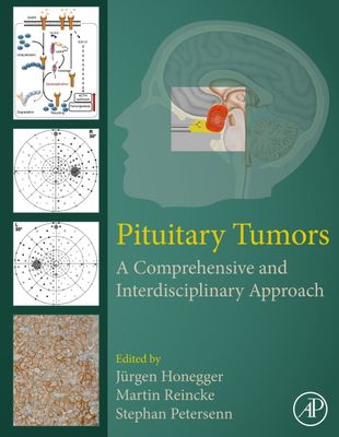Pituitary Tumors: A Comprehensive and Interdisciplinary Approach