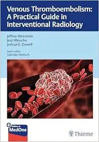 Venous Thromboembolism: A Practical Guide in Interventional Radiology