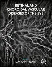 Retinal and Choroidal Vascular Diseases of the Eye