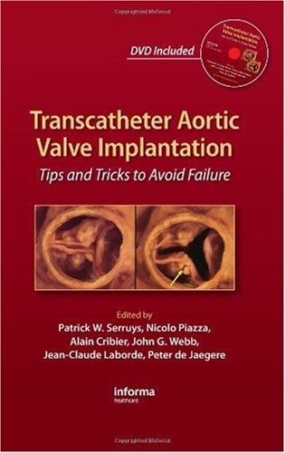 Transcatheter Aortic Valve Implantation: Tips and Tricks to Avoid Failure