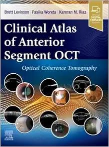 Clinical Atlas of Anterior Segment OCT: Optical Coherence Tomography