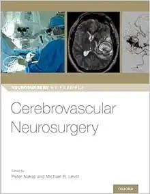 Cerebrovascular Neurosurgery (Neurosurgery by Example)