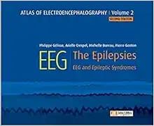 Atlas of electroencephalography:The Epilepsies. EEG and epileptic syndromes Vol 2