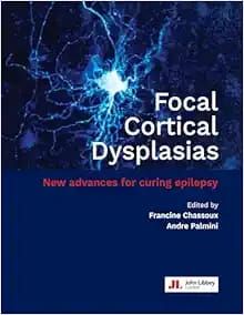 Focal Cortical Dysplasias: New advances for curing epilepsy