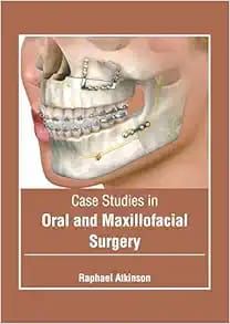 Case Studies in Oral and Maxillofacial Surgery