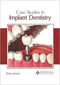Case Studies in Implant Dentistry