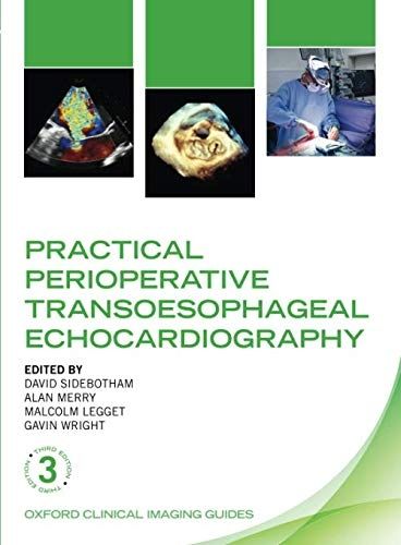 Practical Perioperative Transoesophageal Echocardiography (Oxford Clinical Imaging Guides), 3rd Edition