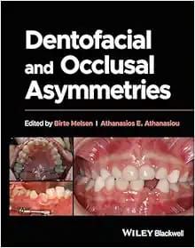 Dentofacial and Occlusal Asymmetries