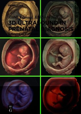 3D Ultrasound in Prenatal Diagnosis: A Practical Approach, 2nd edition