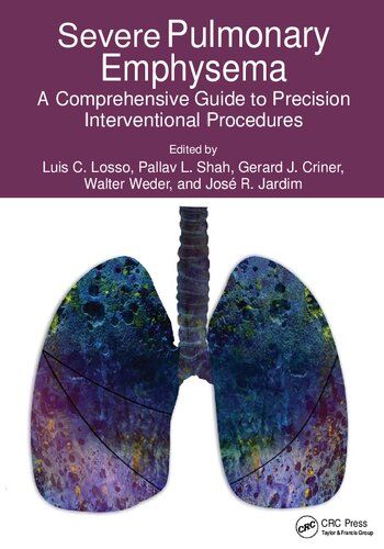 Severe Pulmonary Emphysema:: A Comprehensive Guide to Precision Interventional Procedures 1st Edition