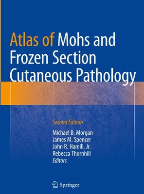 Atlas of Mohs and Frozen Section Cutaneous Pathology
2nd Edition