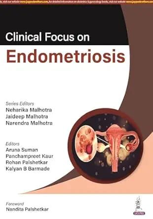 Clinical Focus On Endometriosis