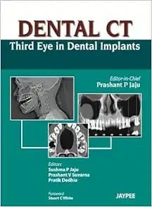 Dental CT: Third Eye In Dental Implants