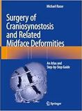 Surgery of Craniosynostosis and Related Midface Deformities: An Atlas and Step-by-Step Guide