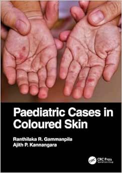 Paediatric Cases in Coloured Skin