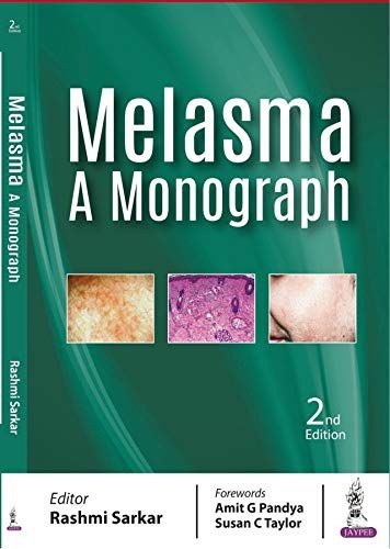 Melasma: A Monograph, 2nd Edition
