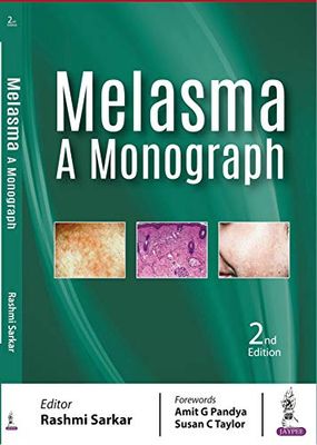 Melasma: A Monograph, 2nd Edition