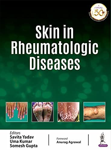 Skin In Rheumatologic Diseases