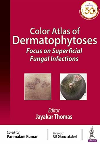 Color Atlas Of Dermatophytoses: Focus On Superficial Fungal Infections